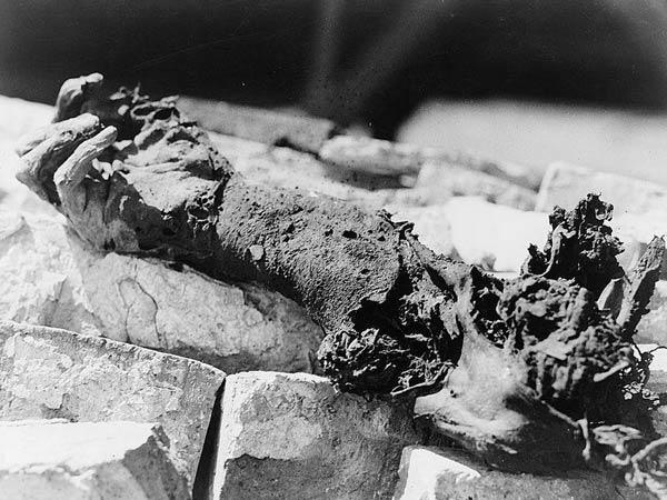 日军轰炸后中国平民的遗体残余