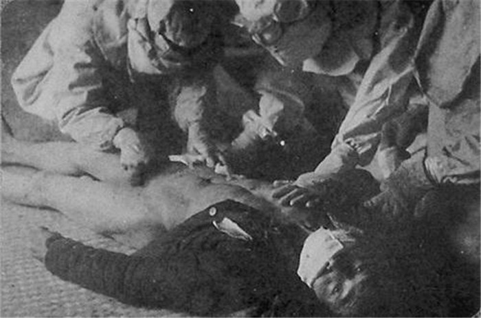 731部队儿童解剖图片